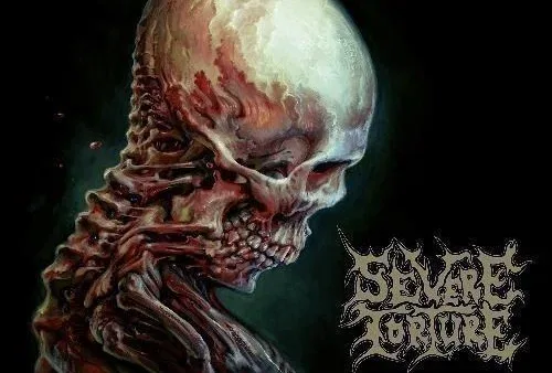 Severe Torture – Torn From the Jaws of Death [2024]