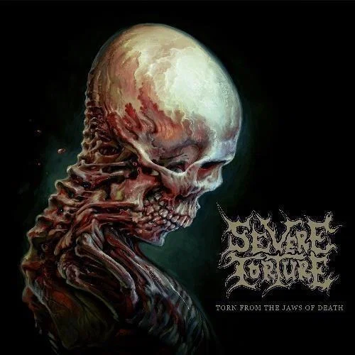 Severe Torture – Torn From the Jaws of Death [2024]